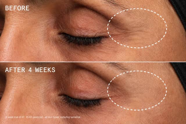 Beauty Pie’s before-and-after images show the appearance of the eye area following four weeks of using YOUTHBOMB Intense. The brand says its trial involved 67 people aged 35 to 65.