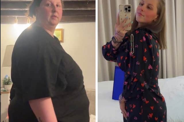 A recent before and after showing the incredible transformation