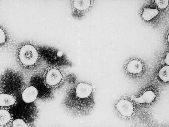 The high coronavirus infection rate in Bedford is beginning to decline