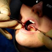 NHS dental check ups in Bedfordshire dropped significantly during lockdown