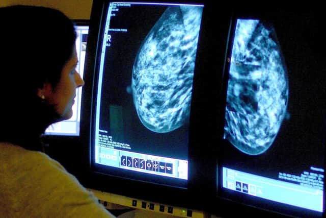 Breast Cancer Now said the "frightening consequence" of such vital targets being missed across England was that more women could be living with the disease without knowing
