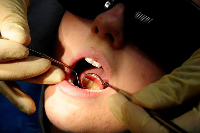 The British Dental Association warned the impact of the pandemic on the nation's oral health will be felt "for years to come"