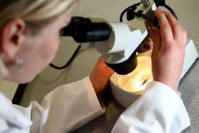 A smear test being analysed