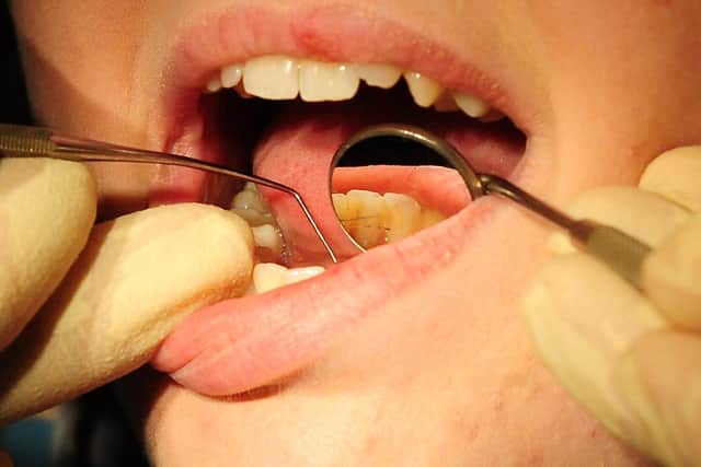37,700 dental treatments were given to NHS patients in Bedford between June 2020 and March this year – a 70 per cent drop