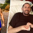 A once super-fit personal trainer is having learning to walk again after both legs and all his fingers were amputated when he suffered life-threatening sepsis. Health-conscious James MacKay, 52, from Cranfield developed a cough that wouldn't go away. PHOTOS: SWNS