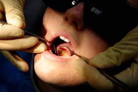 There were an estimated 75 hospital admissions in Bedford for children's tooth extraction in the year to March 2023. Of these, about 20 were extractions for tooth decay