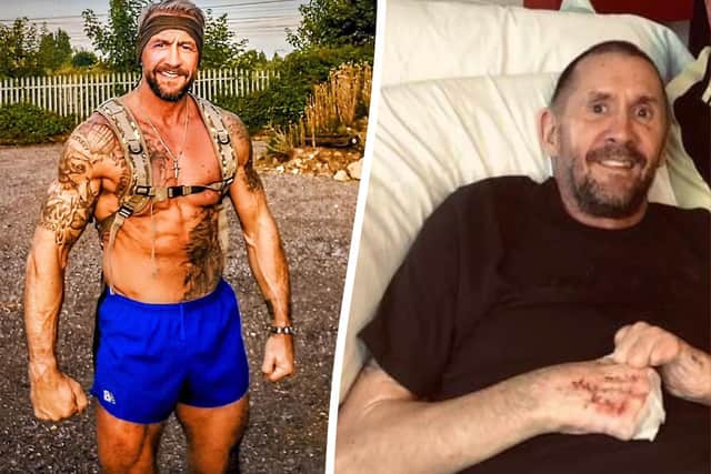 A once super-fit personal trainer is having learning to walk again after both legs and all his fingers were amputated when he suffered life-threatening sepsis. Health-conscious James MacKay, 52, from Cranfield developed a cough that wouldn't go away. PHOTOS: SWNS