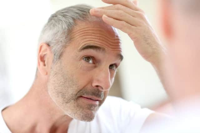 Cure for baldness and grey hair a step closer